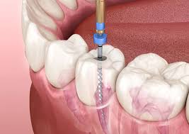 Endodontia